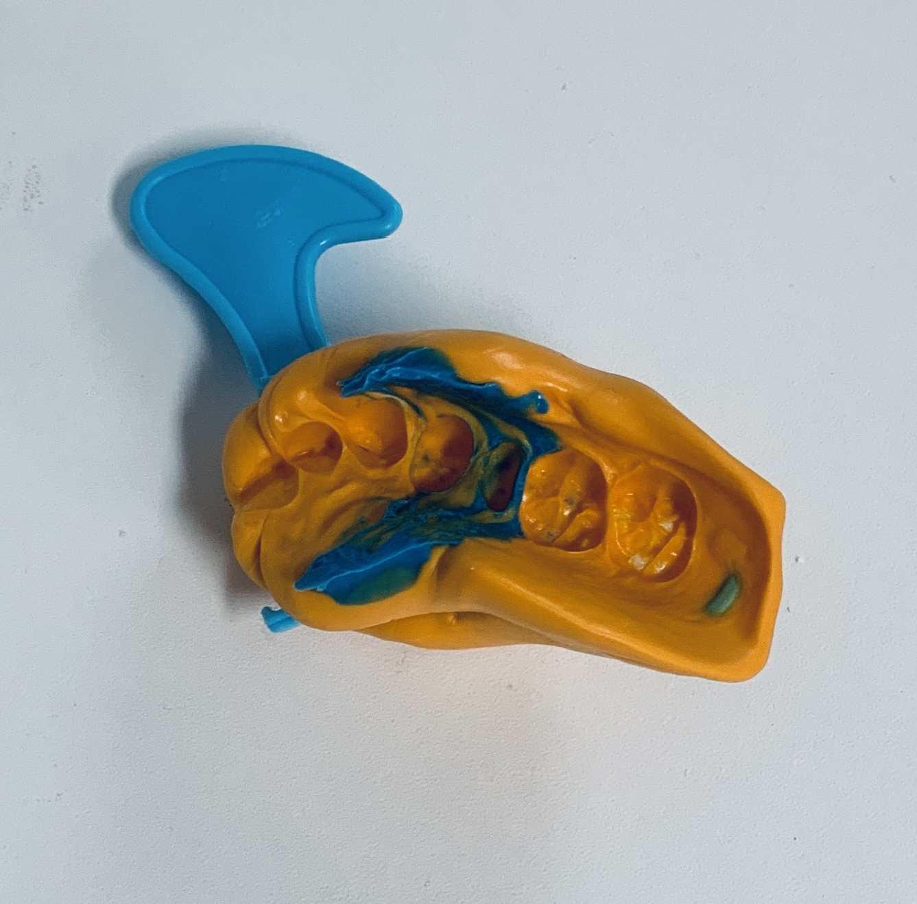 Intraorální scanner MEDIT při skenování
